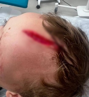 Собака напала на внука писательницы Дарьи Донцовой